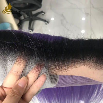 T1b/สีม่วงบริเวณบริเวณบริเวณบริเวณบริเวณบริเวณบริเวณบริเวณประจํา