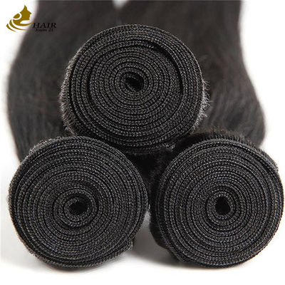 ไม่มีการถอดผมบริเวณบริเวณบริเวณบริเวณบริเวณบริเวณบริเวณบริเวณบริเวณ